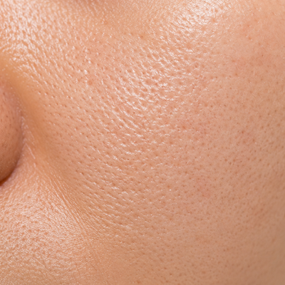 Oil Control/Pores