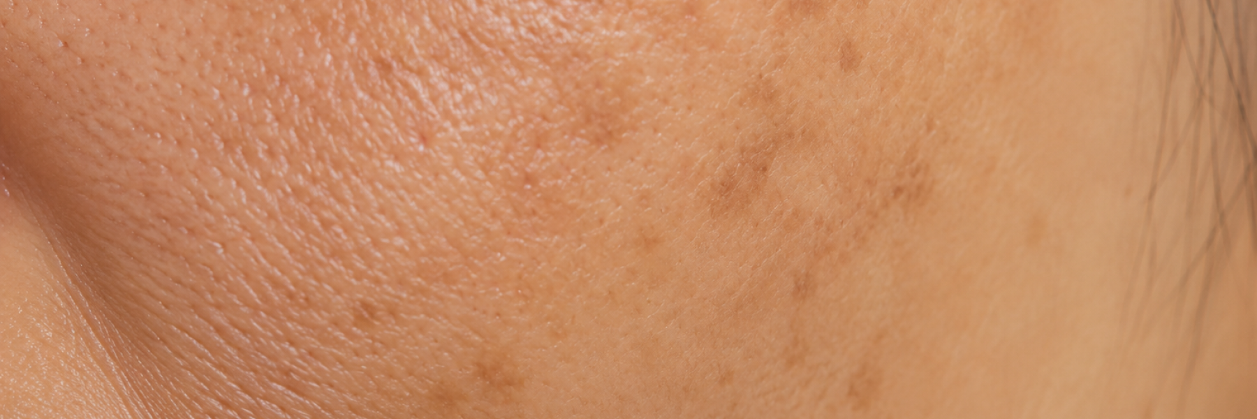 Pigmentation/Brightening