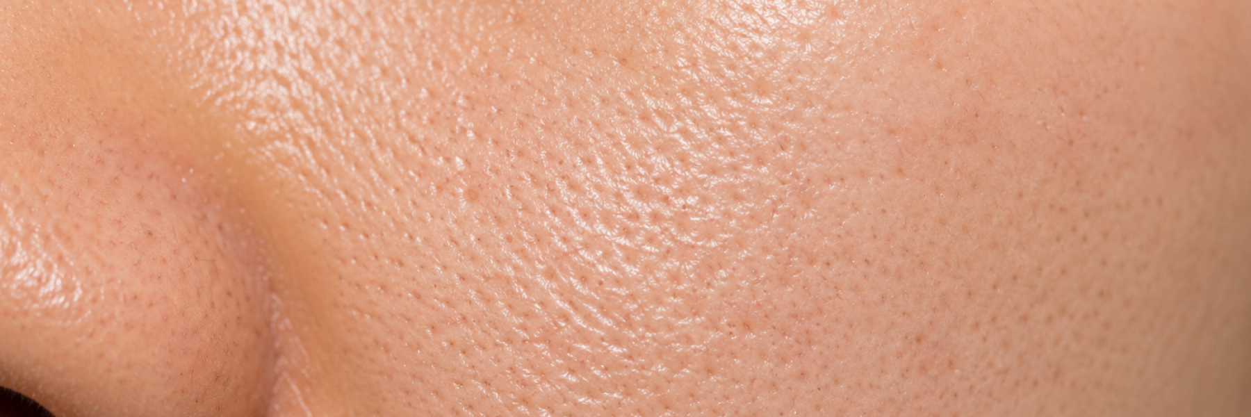 Oil Control/Pores